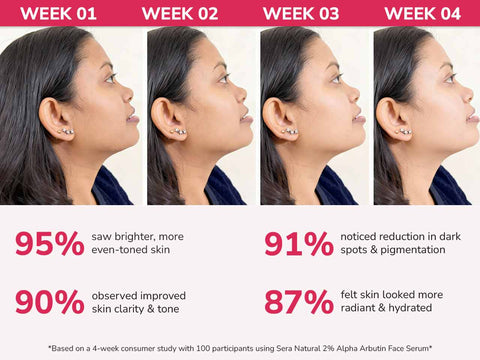 2% Alpha Arbutin Face Serum with Hyaluronic Acid & Pomegranate Extract