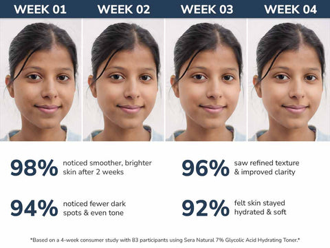 7% Glycolic Acid Hydrating Toner with Ceramides & White Daisy Flower Extract