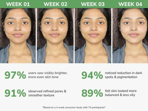 10% Niacinamide Face Serum with 1% Zinc & Mango Fruit Extract