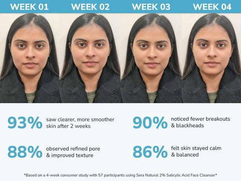 2% Salicylic Acid Face Cleanser with Glycolic Acid & Cica Extract